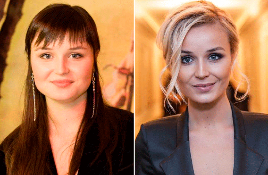 Полина гагарина до и после пластики: как певице удалось похудеть на 40 килограмм и что она сделала со своим лицом