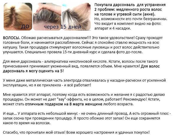 Дарсонваль для роста волос: преимущества и недостатки