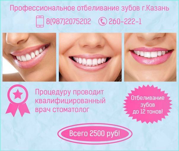 Карандаш для отбеливания зубов- плюсы и минусы, правила пользования