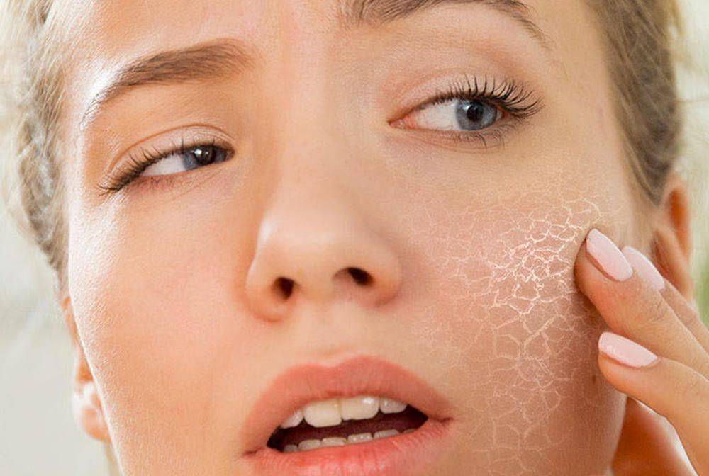 Решение проблемы сухой кожи лица —  блог mygenetics
