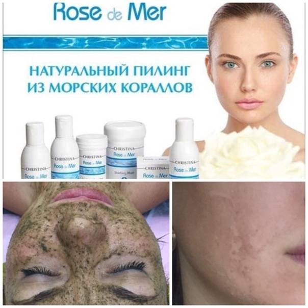 Роз де мер и другие пилинги от кристина