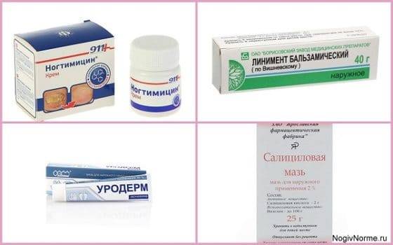 Лучшие препараты для лечения грибка: обзор эффективных противогрибковых кремов, мазей