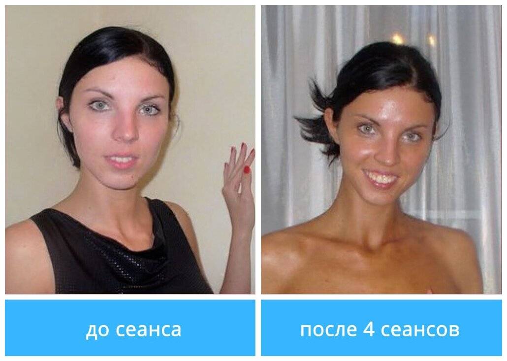 Автозагар для тела – важные правила пользования (2021)