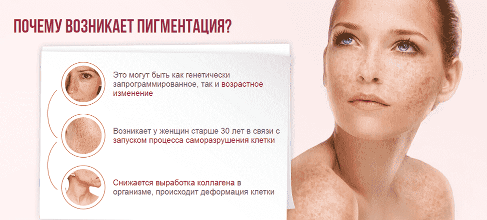 Пигментация лица: причины и методы лечения (2021)