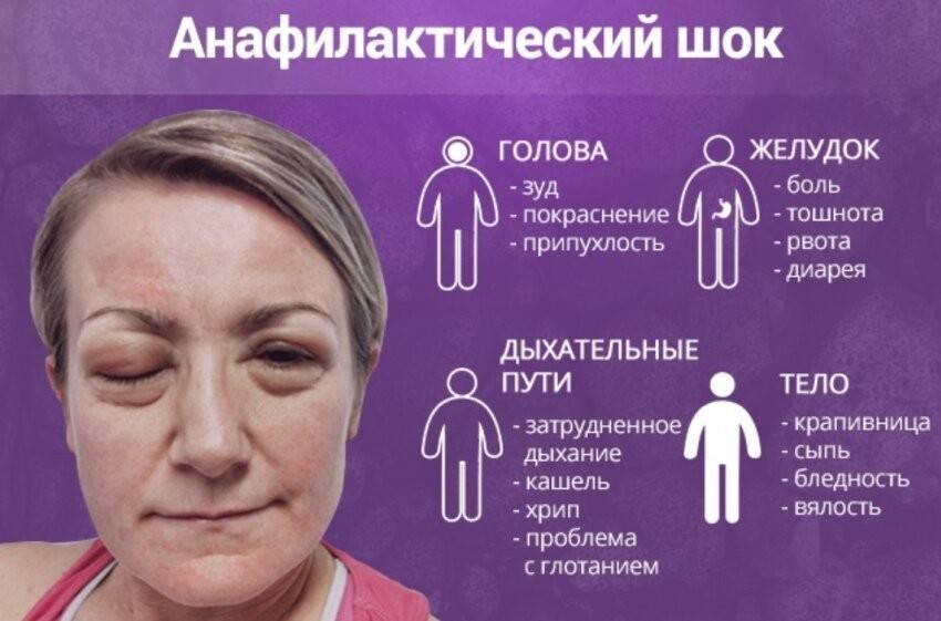 Что такое аллергия и как с ней бороться