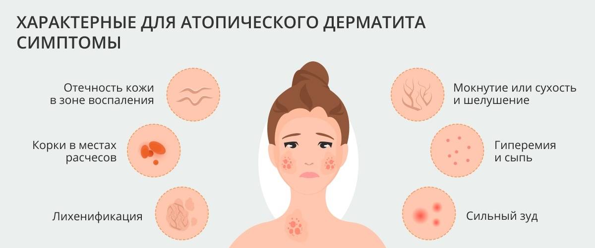 Как лечить прыщи* на подбородке?