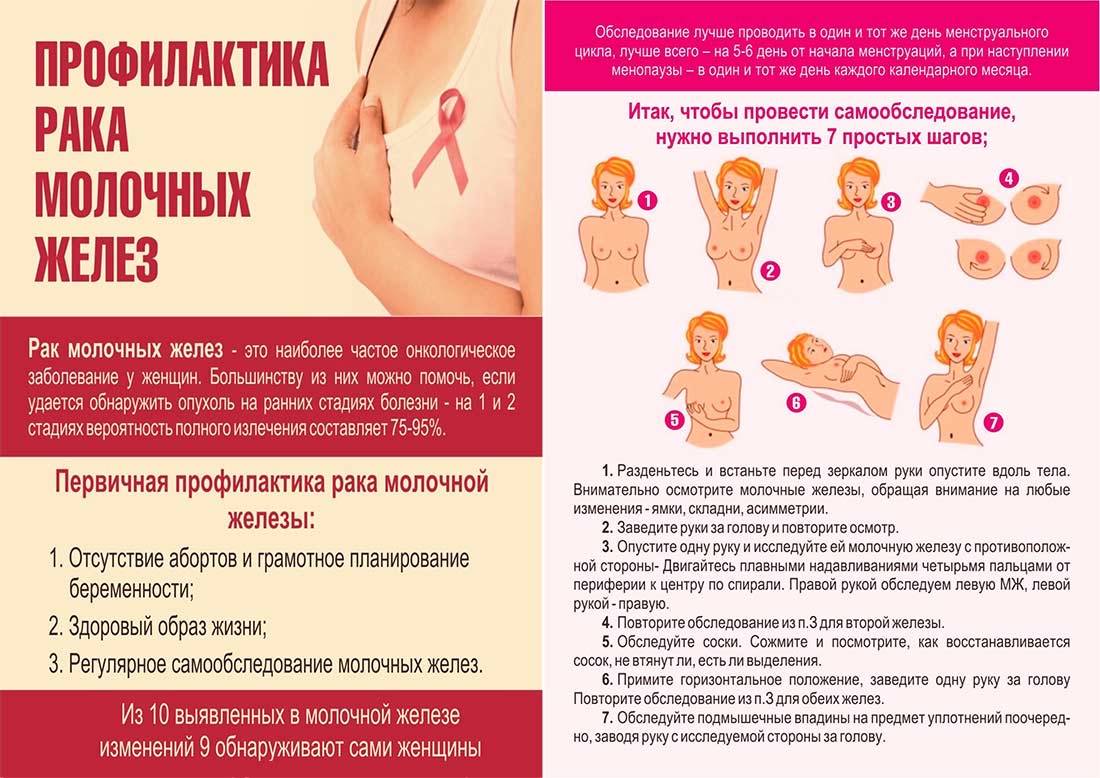 Рак молочной железы