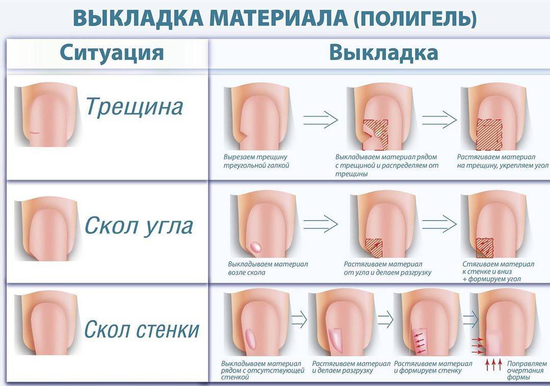 Борьба с тонкостью ногтей: возможно ли укрепление гелем и как провести процедуру?