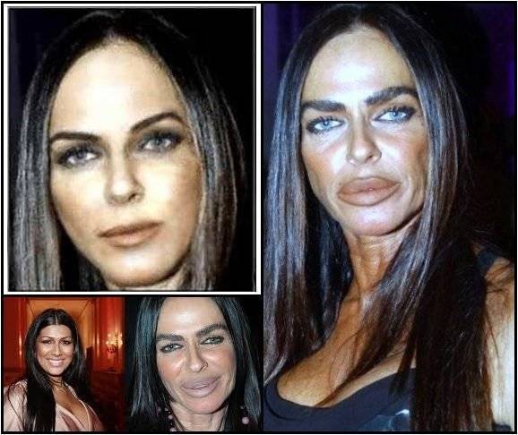 Michaela romanini plastic surgery before and after photos