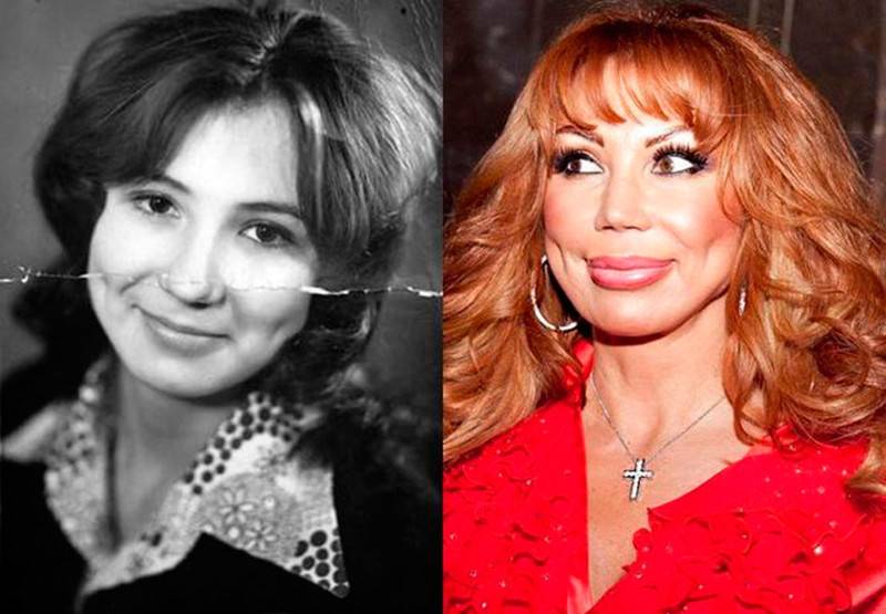 Фото до и после пластики звезд российских, зарубежных, голливуда, шоу-бизнеса, эстрады. удачные и неудачные операции