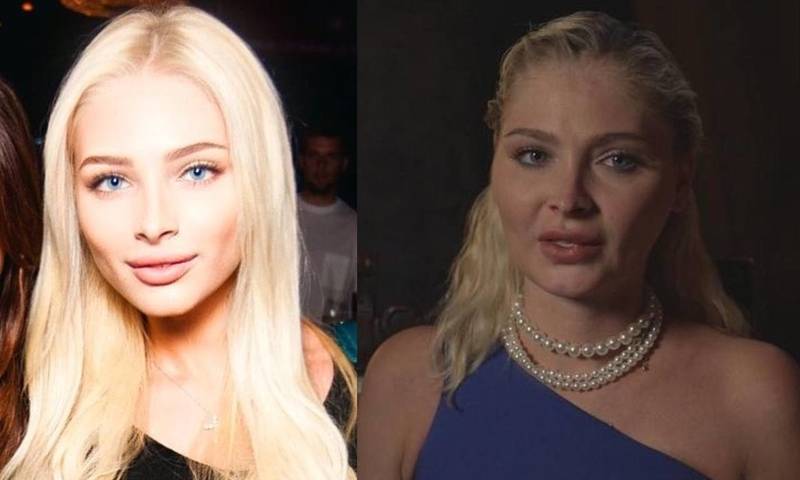 Алёна шишкова фото до и после пластики – скачать бесплатно