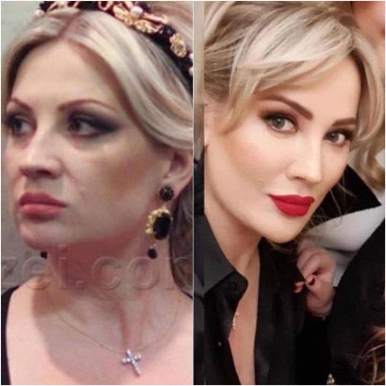 Жена стаса михайлова — инна: биография, фото до и после пластики, сколько детей