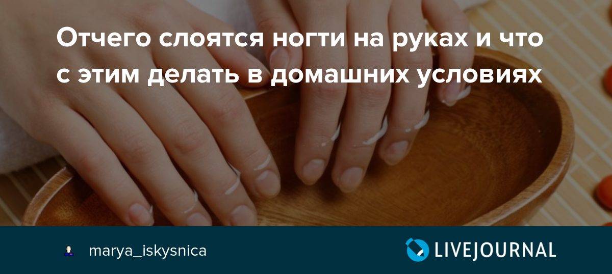 Слоятся ногти на руках: причины и лечение в домашних условиях