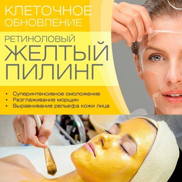 Желтый пилинг - стоит ли процедура омоложения своих денег?