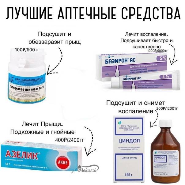 Акне на теле: как избавиться, лечение - минолексин