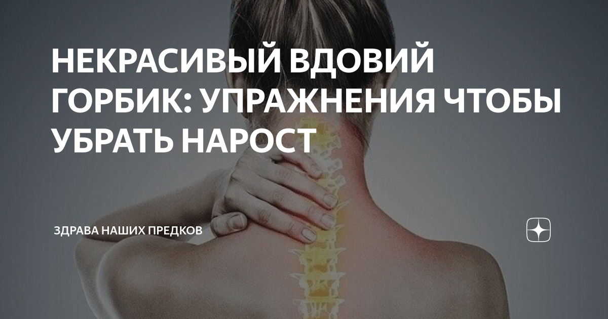 Некрасивый вдовий горбик: упражнения чтобы убрать нарост