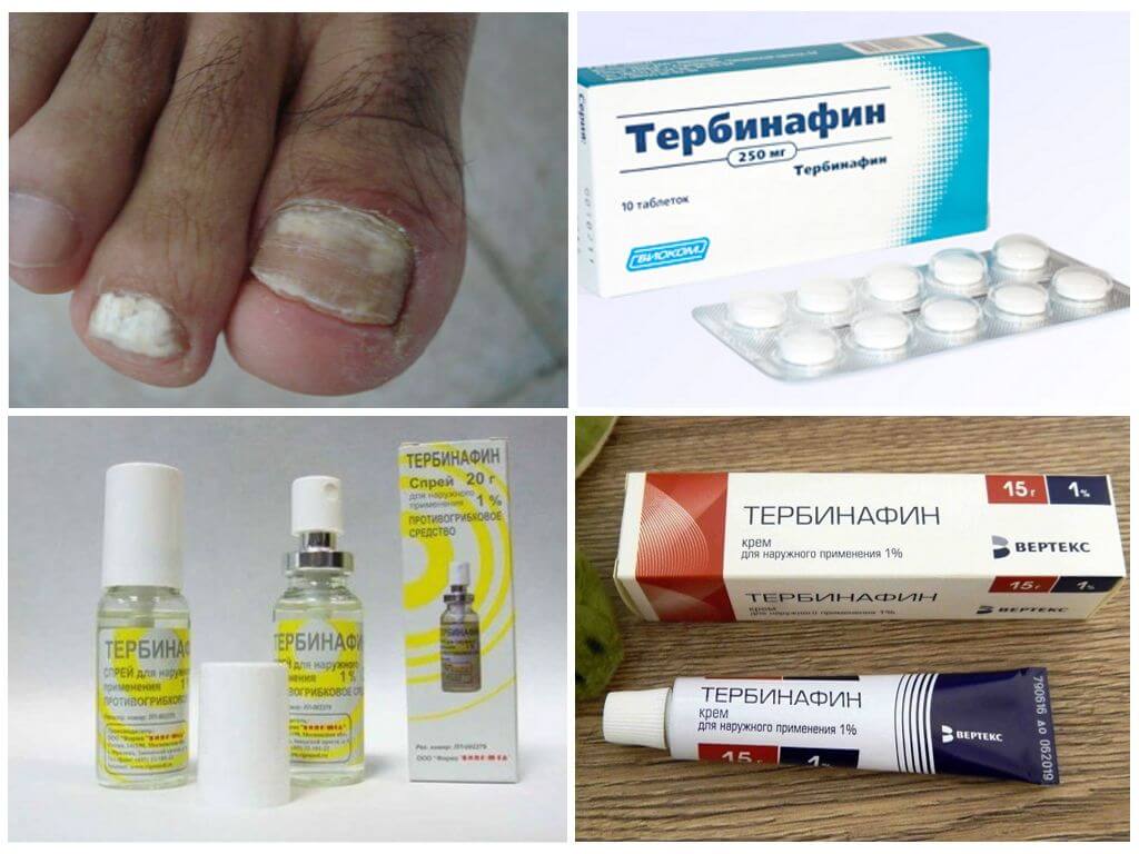 Противогрибковые препараты для ног и ногтей | азбука здоровья