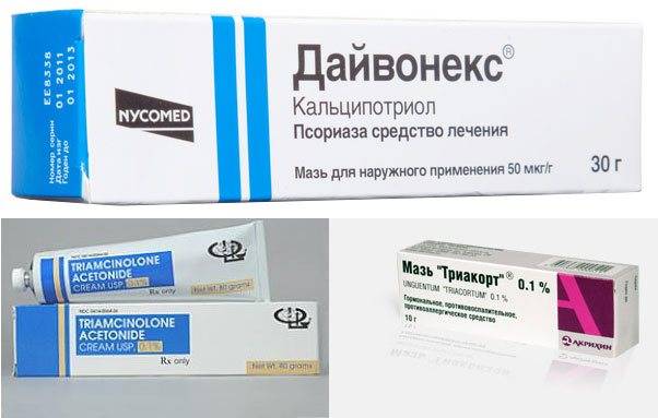 Лечение псориаза лазером. новые методы лечения псориаза.