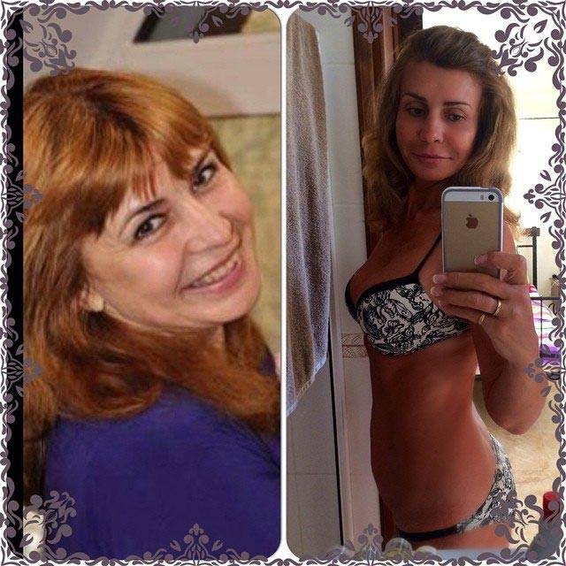 Агибалова ирина александровна до после похудения. ирина агибалова – неудачная пластическая операция, фото до и после. уход с проекта