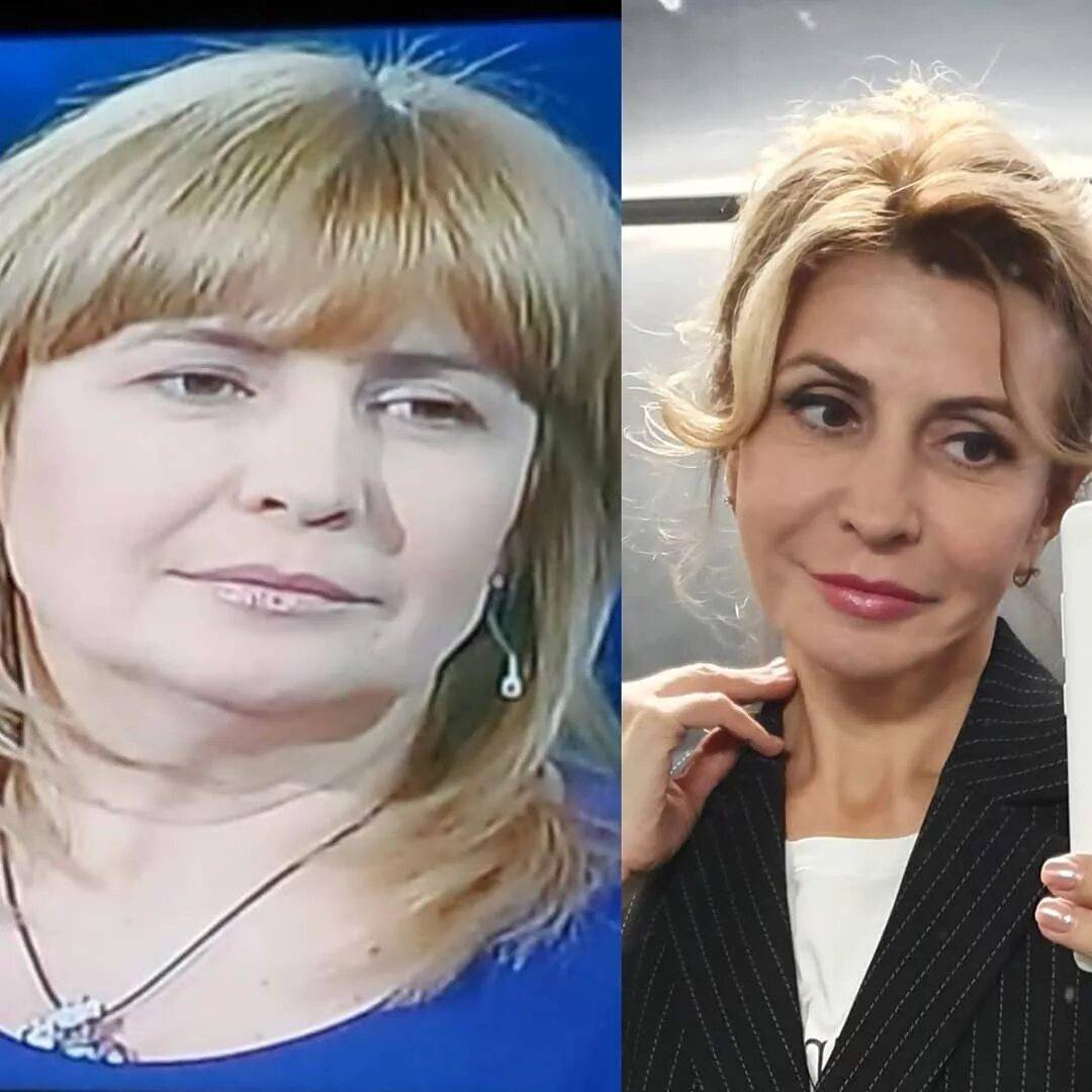 Ирина александровна до и после операции. ирина агибалова – неудачная пластическая операция, фото до и после. личная жизнь ирины агибаловой