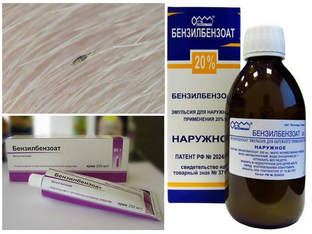 ❶ мазь и эмульсия бензилбензоата при лечении чесотки