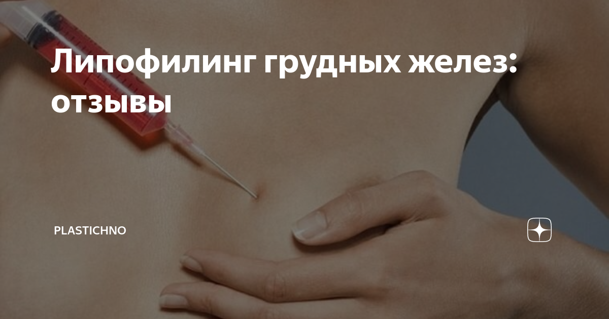 Красивая грудь: импланты или липофилинг?