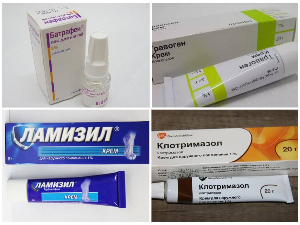 Чем лечить грибок ногтей на ногах: современные средства и методики. профилактика. фото.