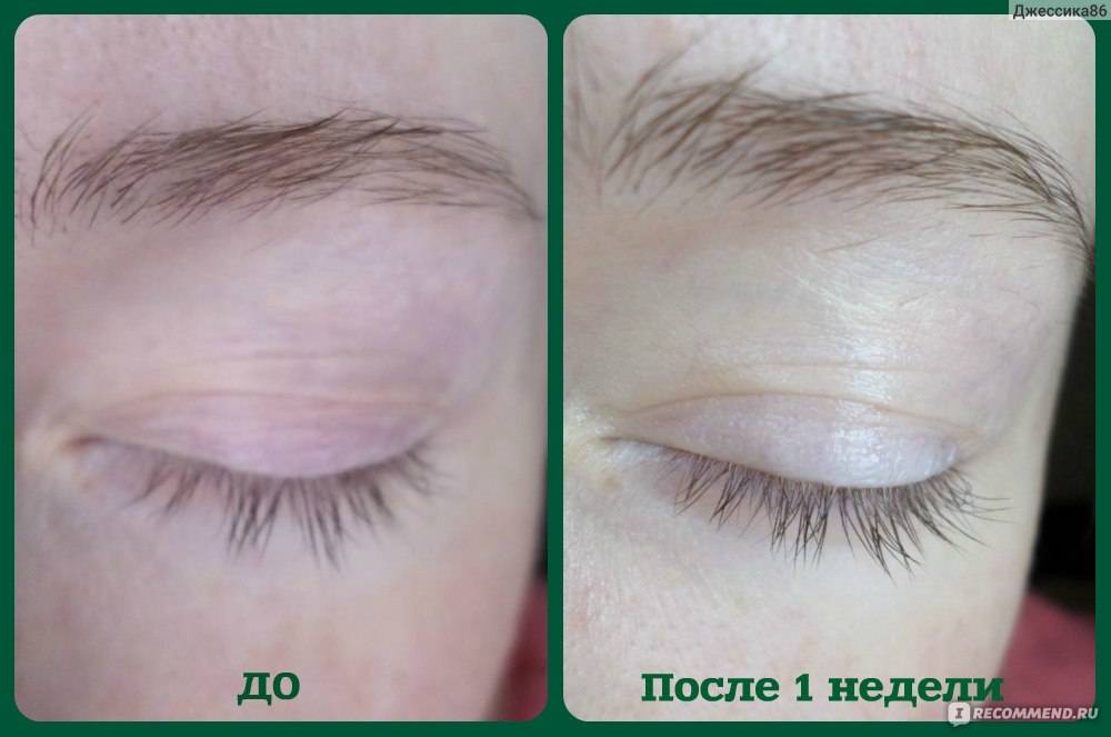 Касторовое масло для ресниц и бровей — способ применения