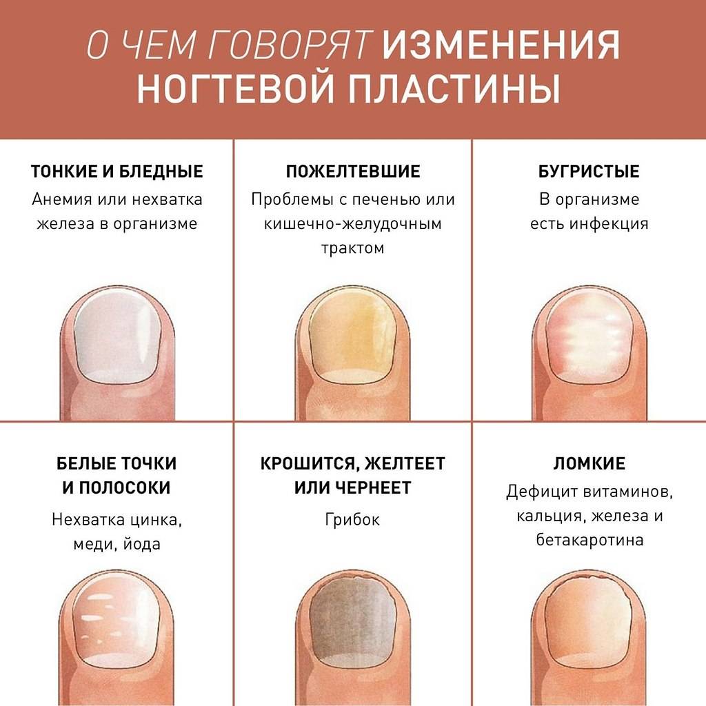 Почему у ребенка медленно растут ногти. почему не растут ногти на руках у ребенка: возможные причины