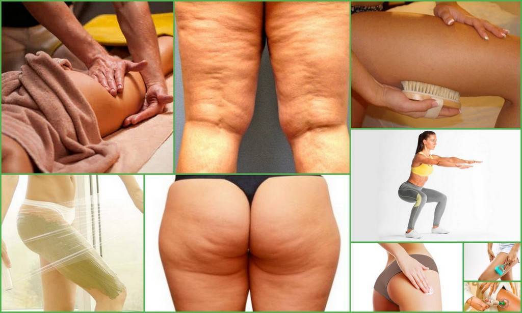 Упражнения для нижней части ягодиц: техника выполнения