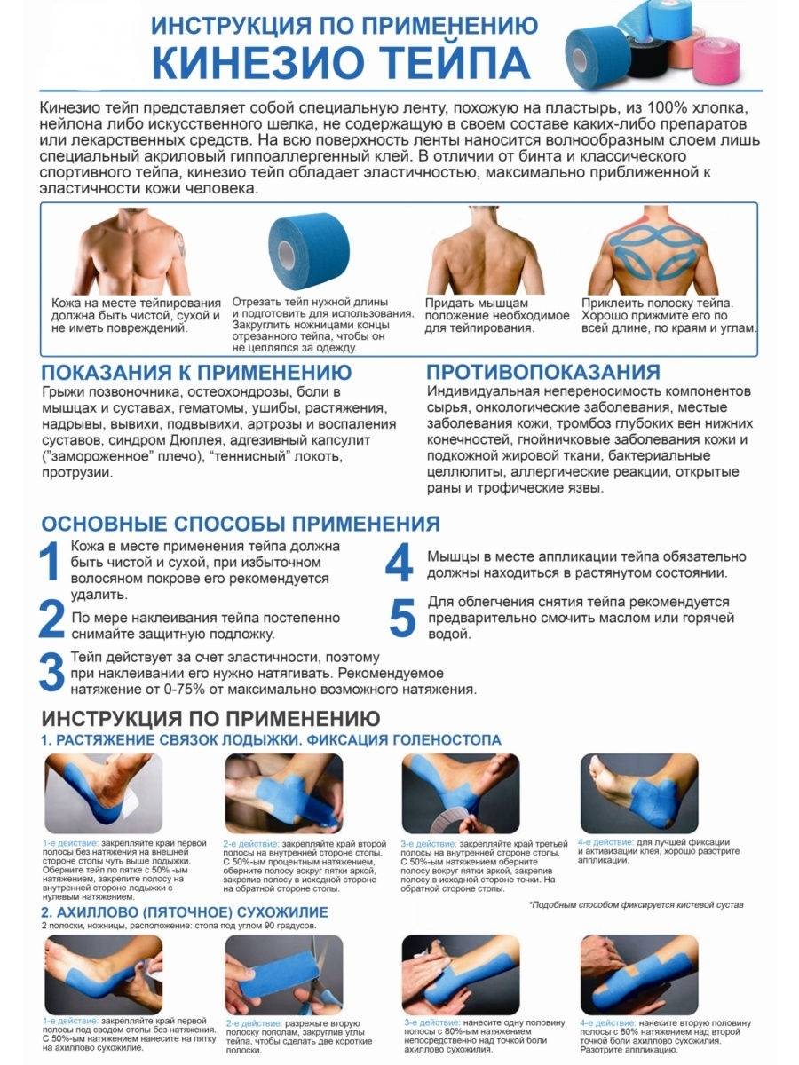 Кинезиотейпирование: медицина или шарлатанство
