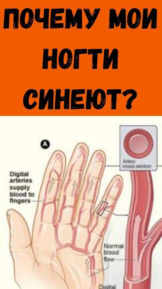 Изменение цвета ногтей. причины. много фото.