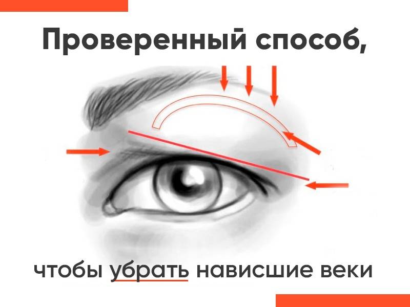 5 способов избавиться от нависшего верхнего века