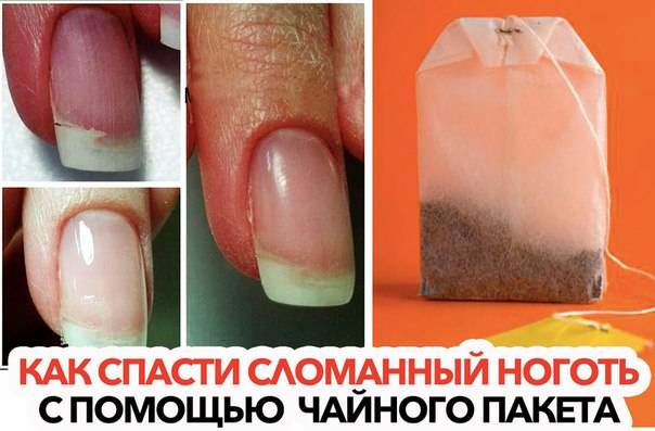 Что делать, если ноготь сломался, в том числе сбоку под гель-лаком: как починить в домашних условиях, отремонтировать в салоне, чем восстановить, как спасти?