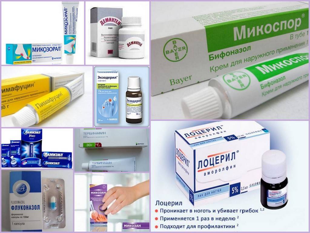 Онихомикоз (грибок ногтей) — основные методы лечения и профилактики