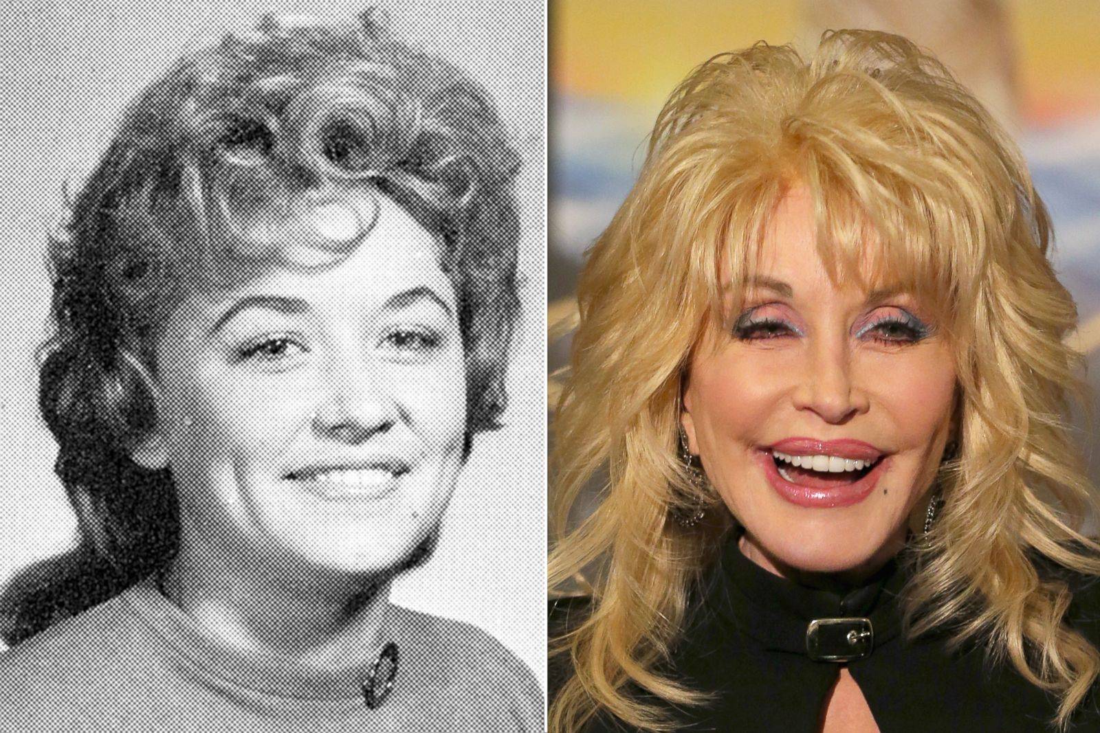 Dolly parton's plastic face fiasco: country queen looks like the joker!