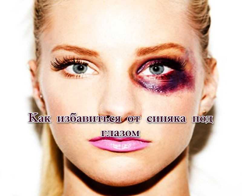 Как сделать себе фингал. как себе сделать безболезненно синяк