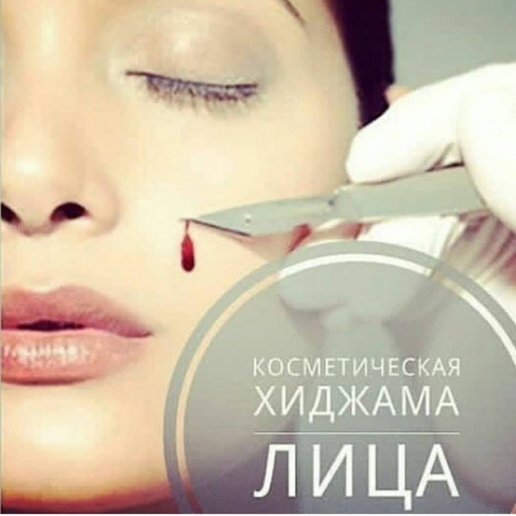 Кровопускание (хиджама) — польза и вред | польза и вред