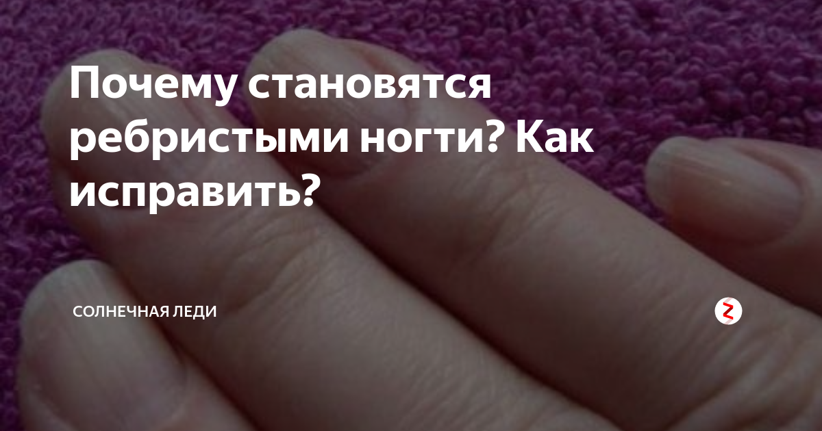 Причины ребристых ногтей на руках