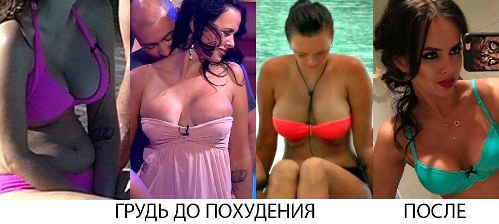Виктория романец до и после пластики