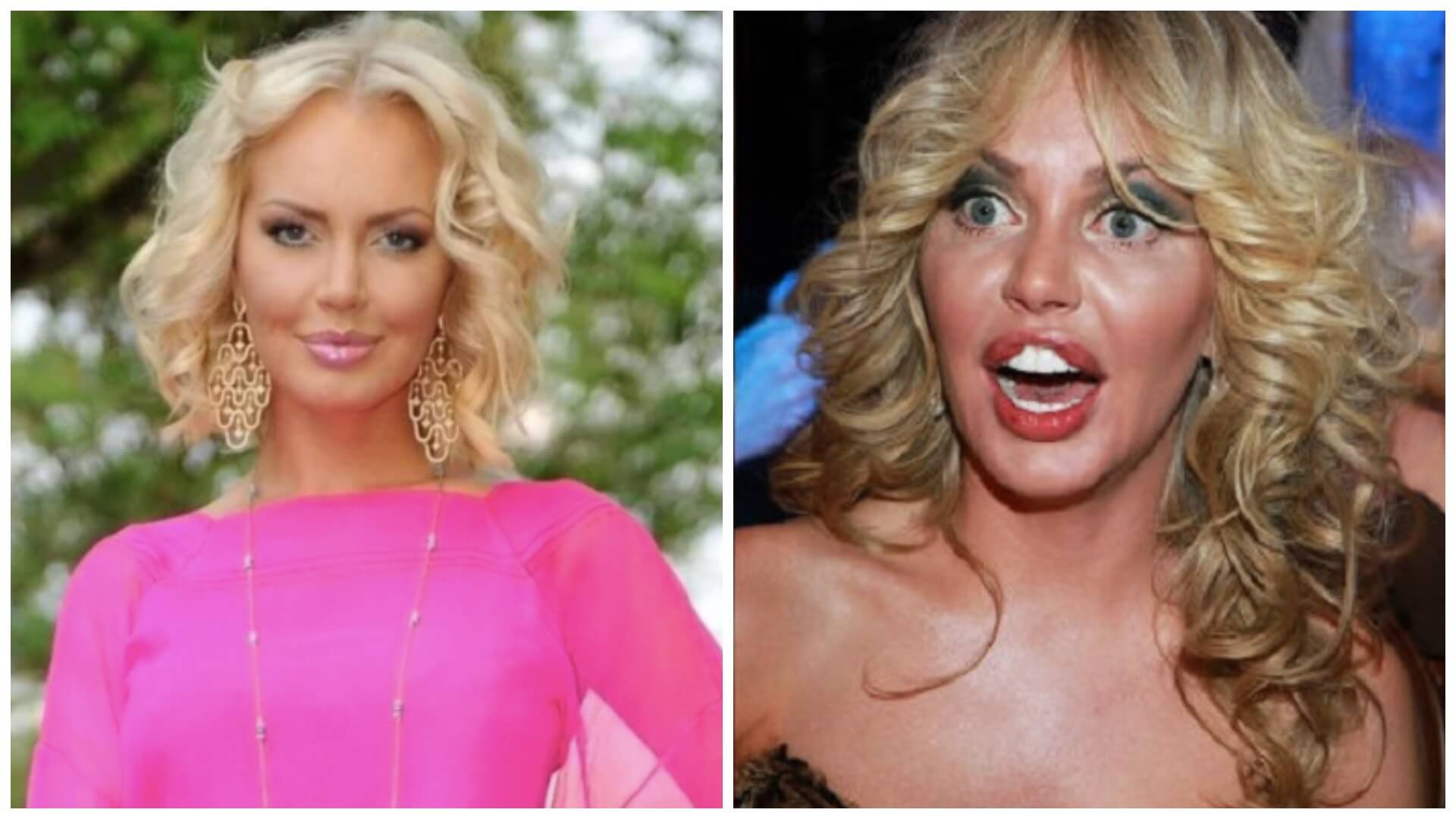 Когда пластика пошла во вред: 20 звезд, которые испортили себе лицо | simpleslim
