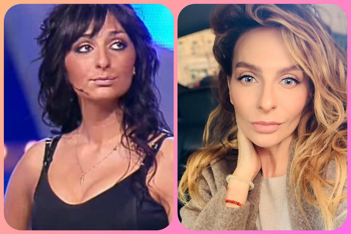 Екатерина варнава до и после пластических операций, фото и видео