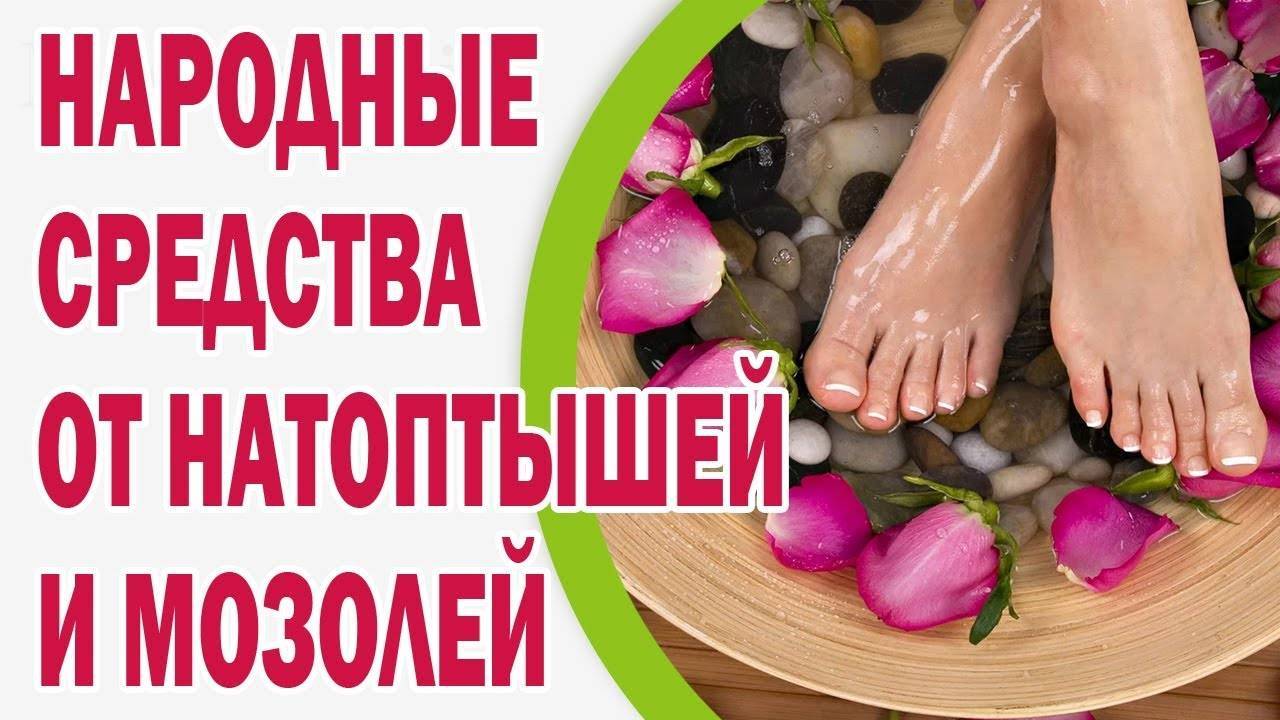 Сухая мозоль на подошве стопы: как вылечить подошвенную мозоль