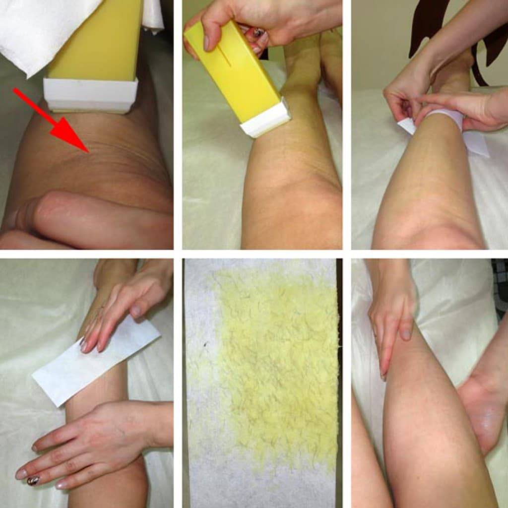 Какая эпиляция подойдет для тонких пушковых волос на лице и теле - unibeauty.ru