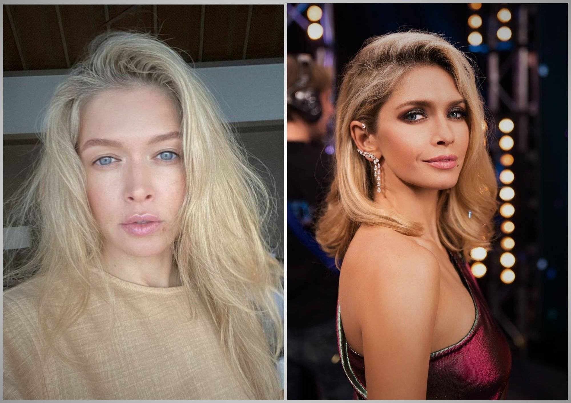 Misha romanova before and after plastic surgery. photo