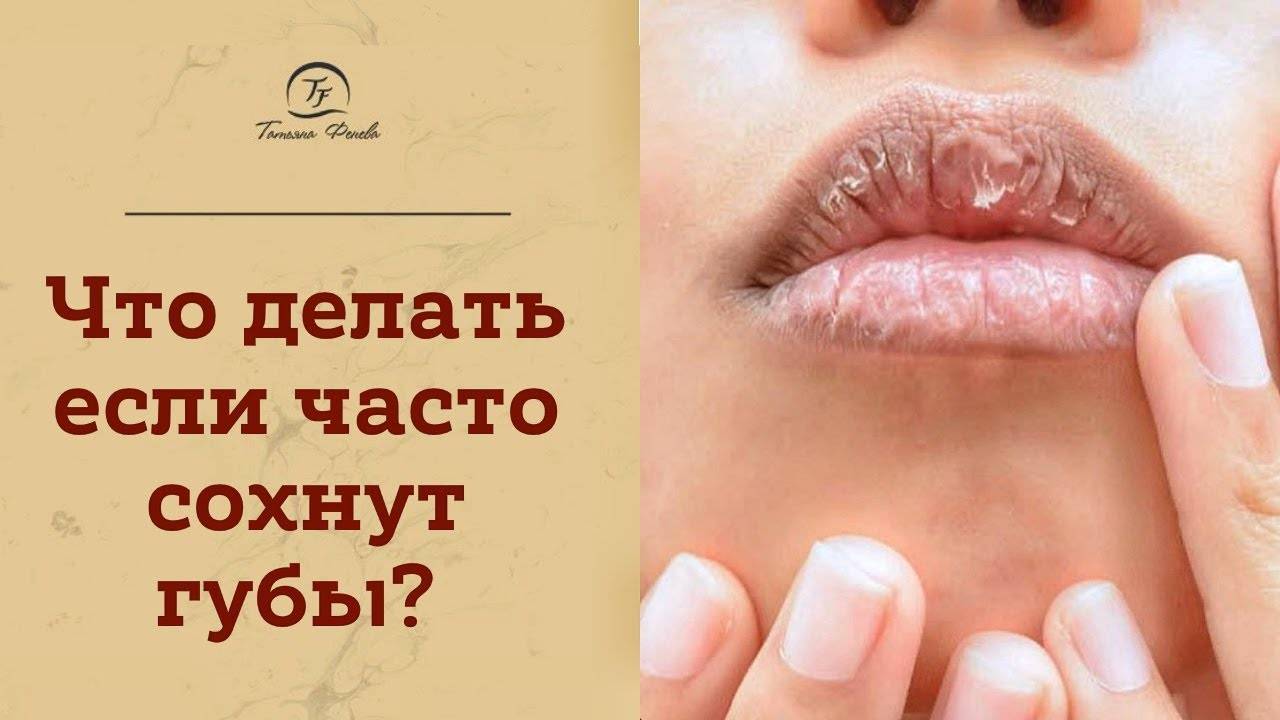 Почему сохнут губы у женщин: основные причины