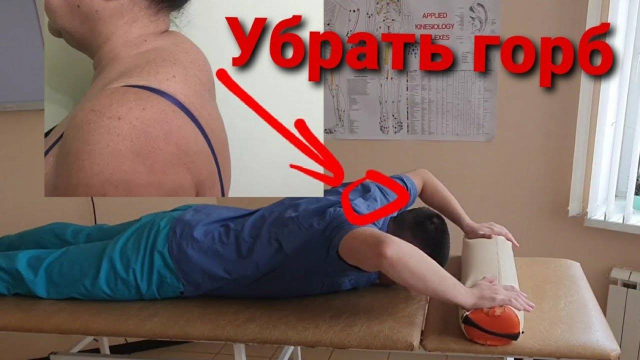 Как убрать холку на шее с помощью упражнений и массажа