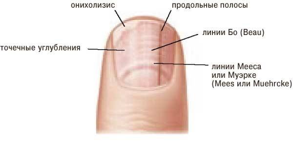 Черное пятно на ногте большого пальца ноги: причины появления, методы устранения проблемы | mfarma.ru