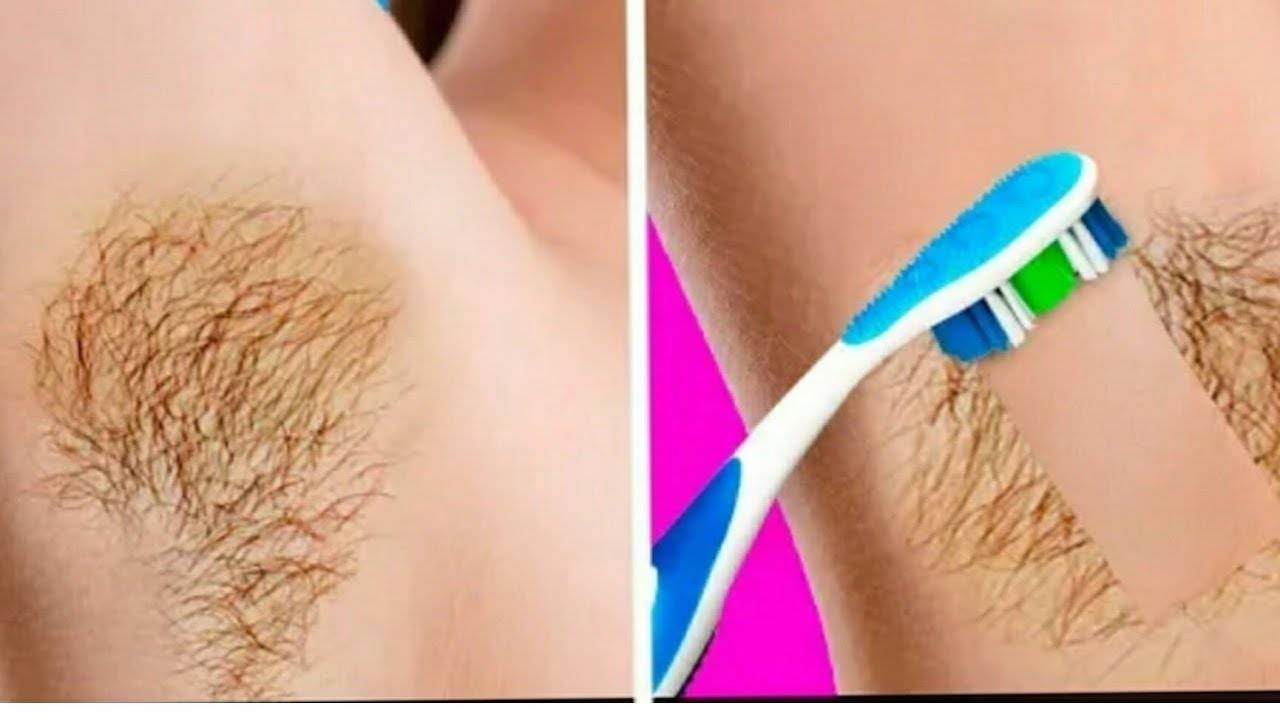 7 способов избавления от волос под мышками: мастер-класс по удалению | bellehair.info