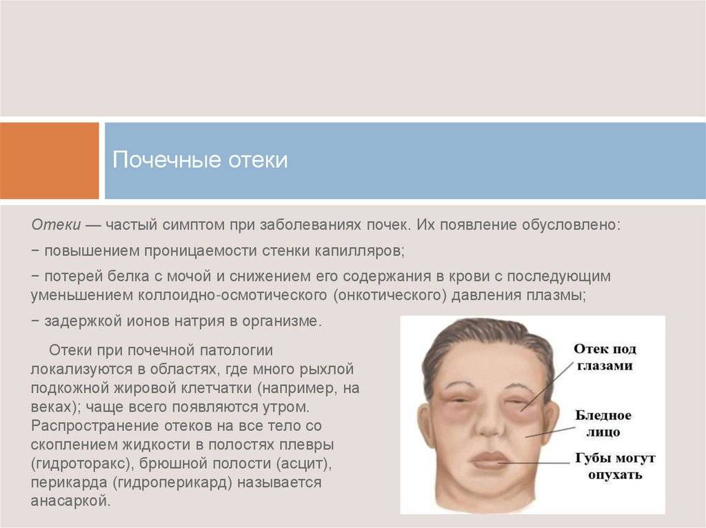 Как зеницу ока. обзор травм глаза